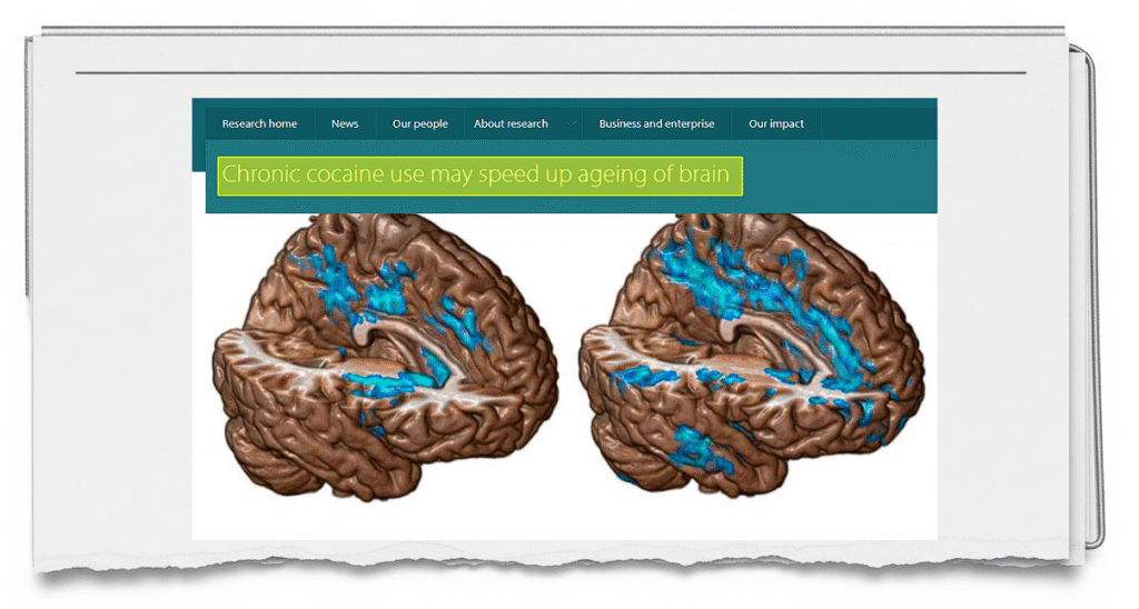 Chronic cocaine use may speed up ageing of brain